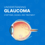 Understanding Glaucoma: Symptoms, Causes, and Treatment-SRG Eye Hospital