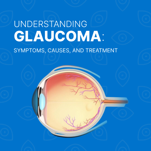 Understanding Glaucoma: Symptoms, Causes, and Treatment-SRG Eye Hospital